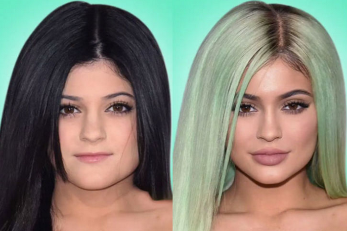 Les Kardashian Avant Et Après La Chirurgie Esthétique ! (Vidéo)